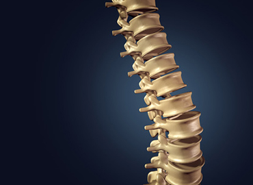 Intervertebral cage